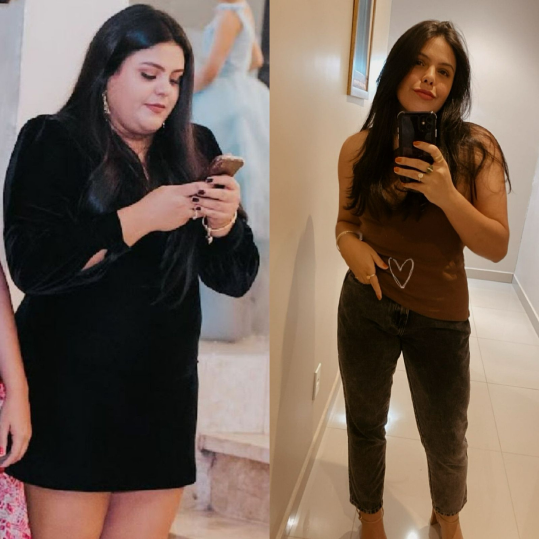 Paciente B - antes e depois