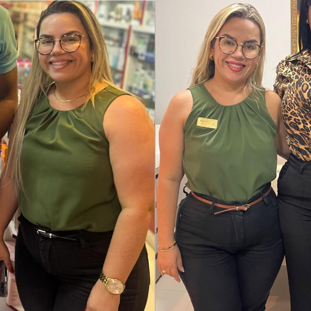 Paciente J - antes e depois