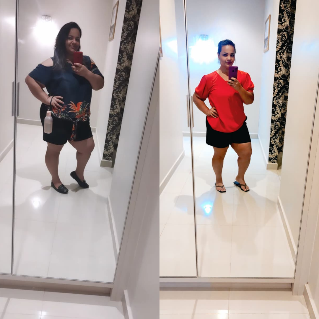 Paciente I - antes e depois