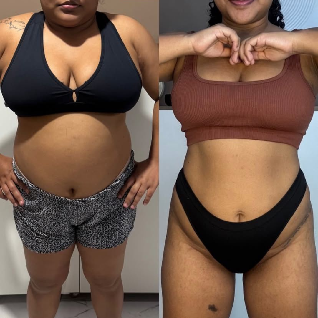 Paciente D - antes e depois